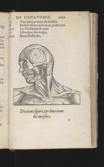 The muscles of the head, from the 'Anatomie universelle'.